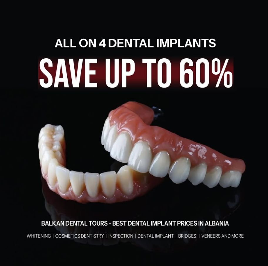 _______impianti-dentali-corone-albania-1