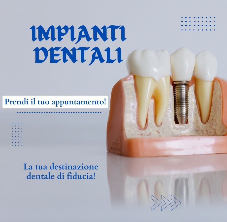 _______impianti-dentali-corone-albania-10