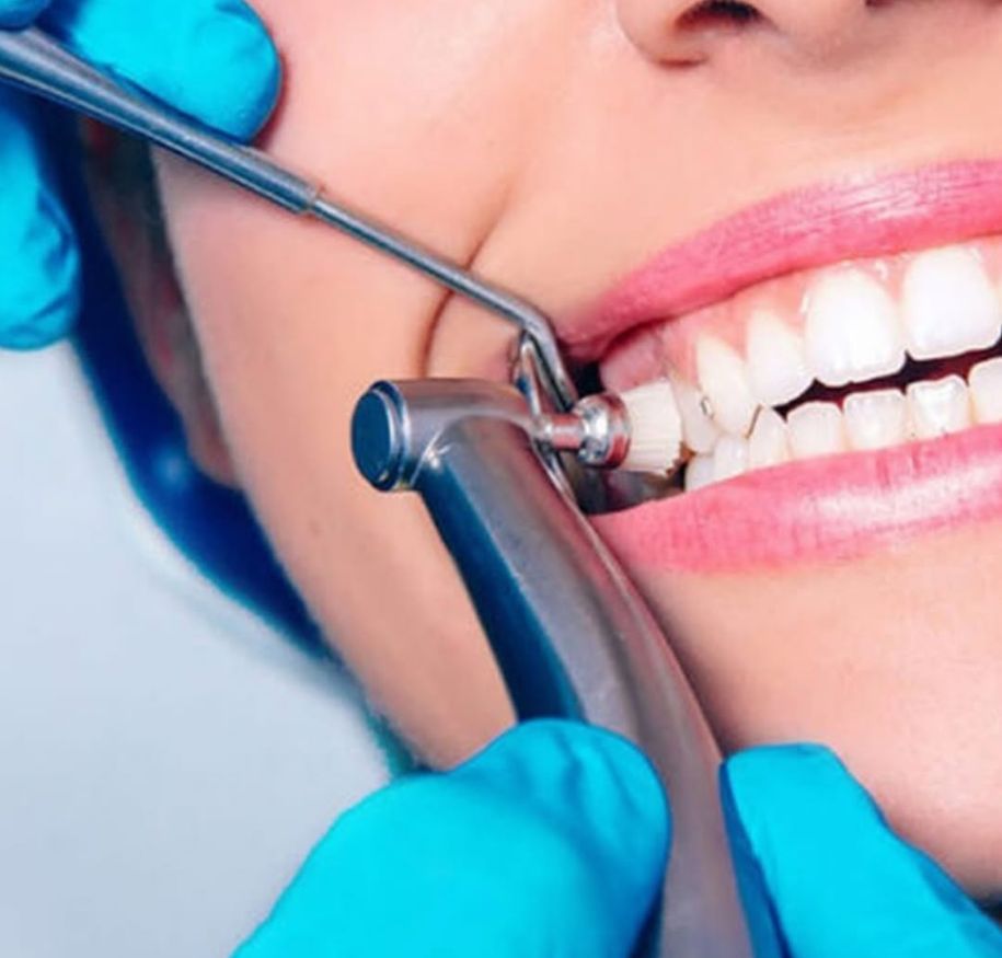 _______impianti-dentali-corone-albania-13