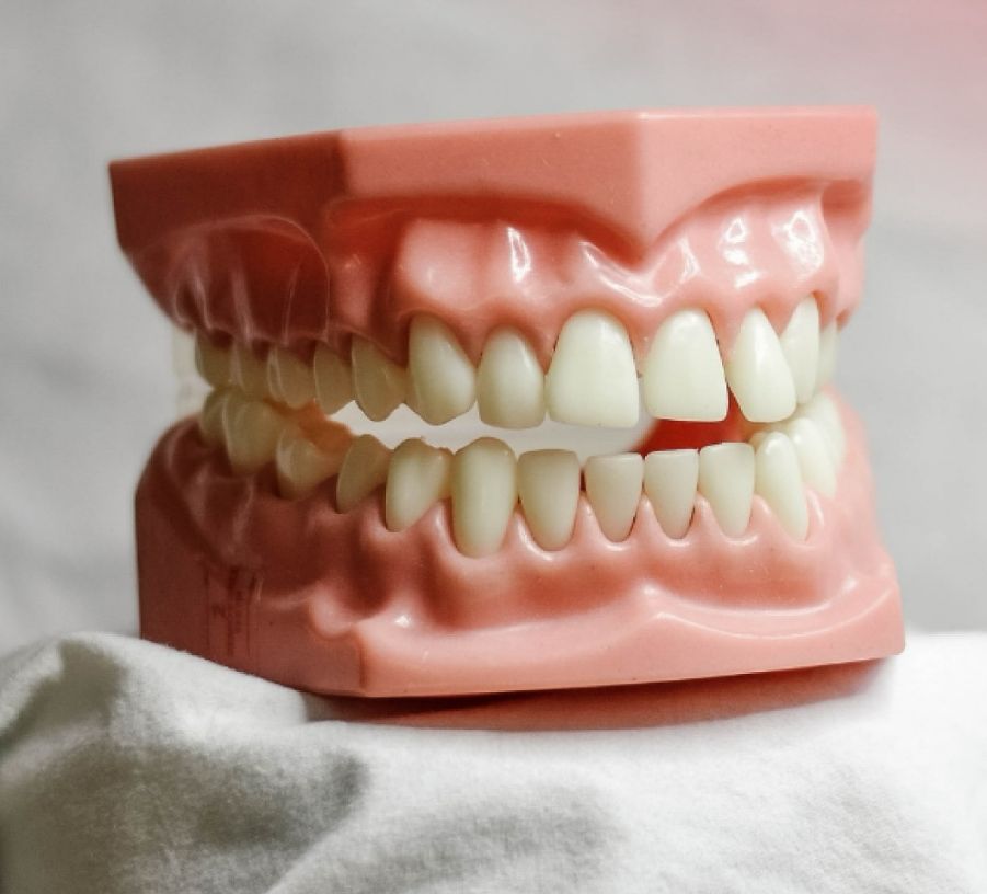 _______impianti-dentali-corone-albania-199