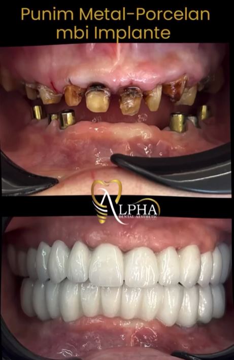 ALPHA-DENTAL-AESTHETIC1