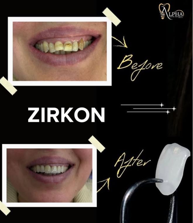 ALPHA-DENTAL-AESTHETIC10