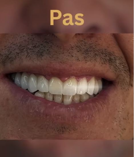 ALPHA-DENTAL-AESTHETIC4