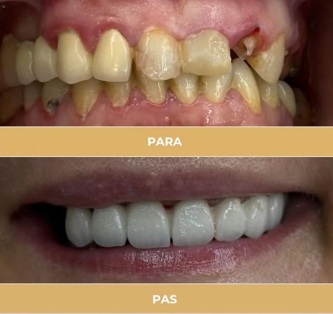 ALPHA-DENTAL-AESTHETIC7