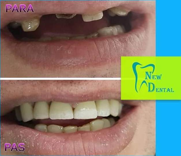 dental-new-klinike-tirana-12