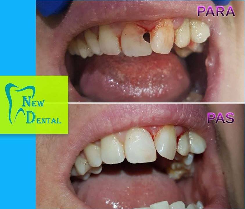 dental-new-klinike-tirana-13