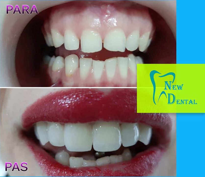 dental-new-klinike-tirana-15