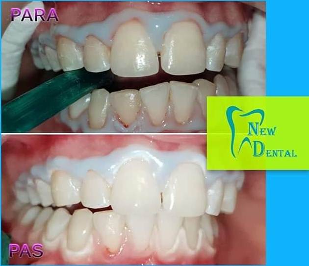 dental-new-klinike-tirana-2