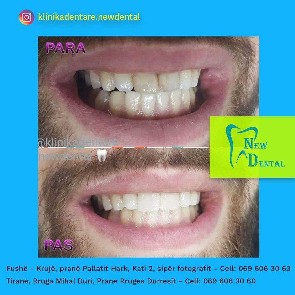 dental-new-klinike-tirana-24