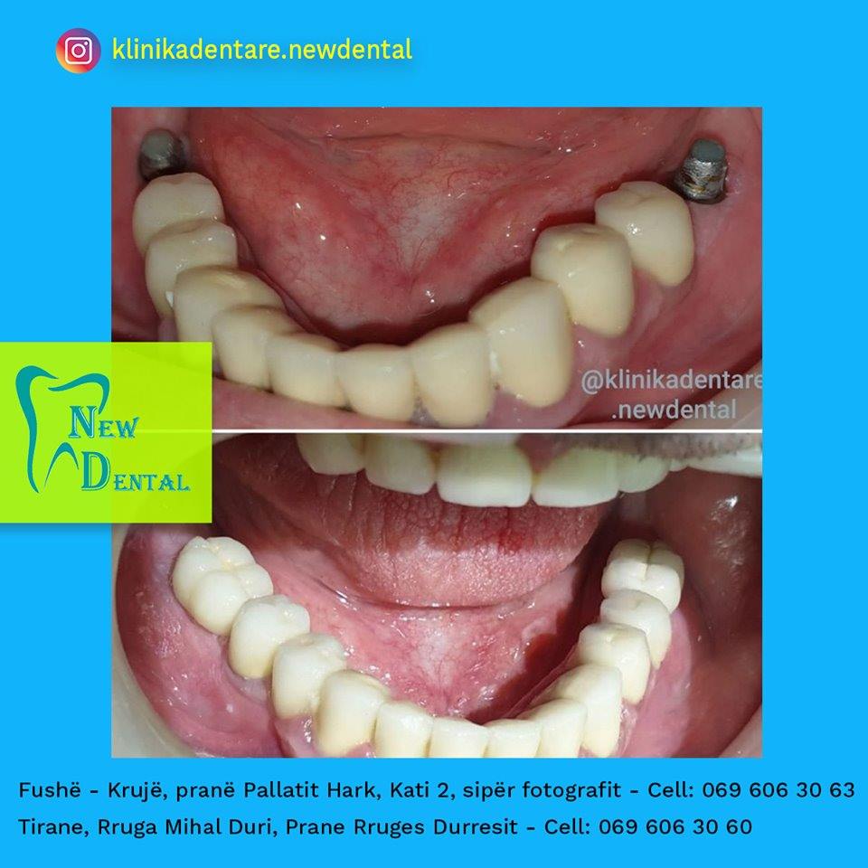 dental-new-klinike-tirana-27