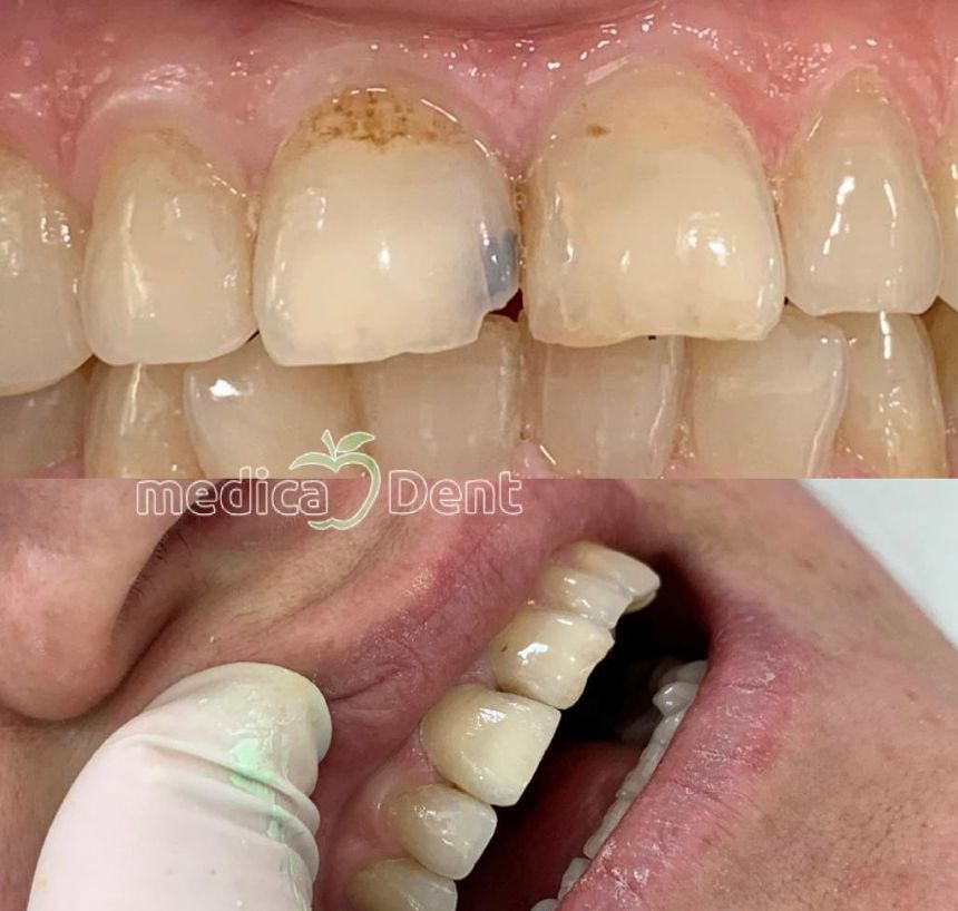 _Dentist-klinike-vlore-16