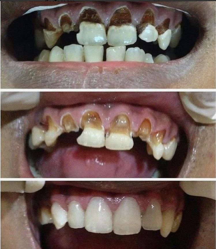 _Dentist-klinike-vlore-17