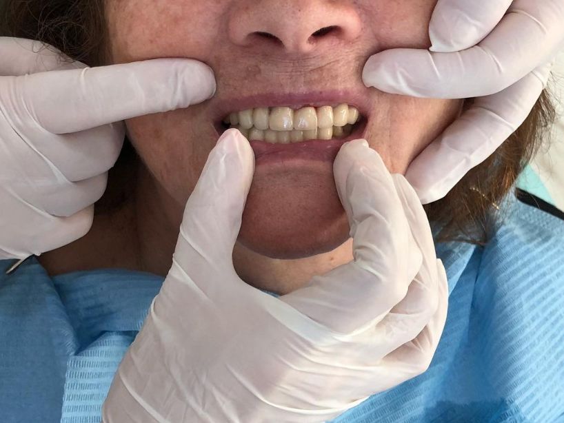 _Dentist-klinike-vlore-192