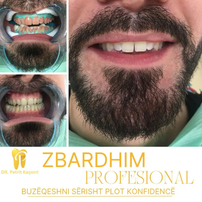 dentist-klinike-laprake-tirane-18