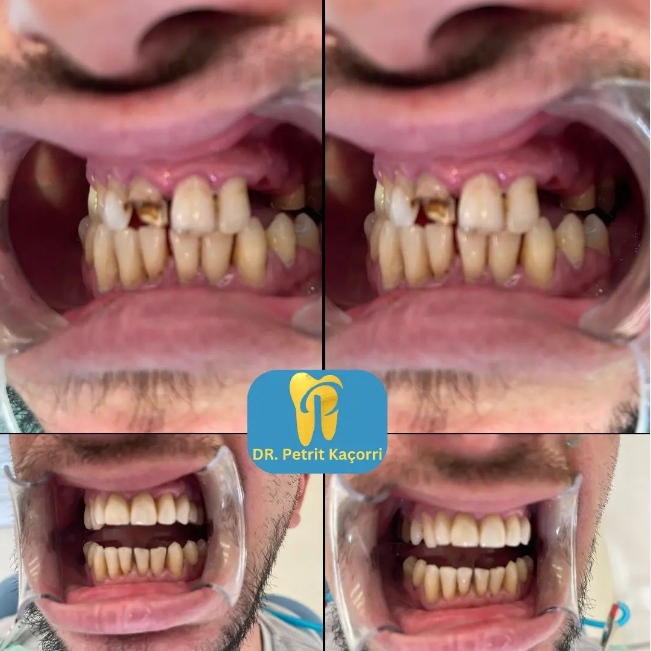 dentist-klinike-laprake-tirane-191