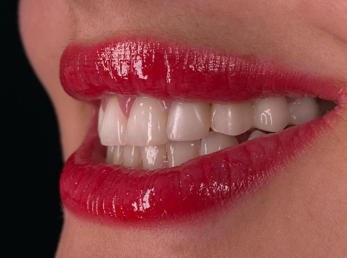_________dentist-tirane-12