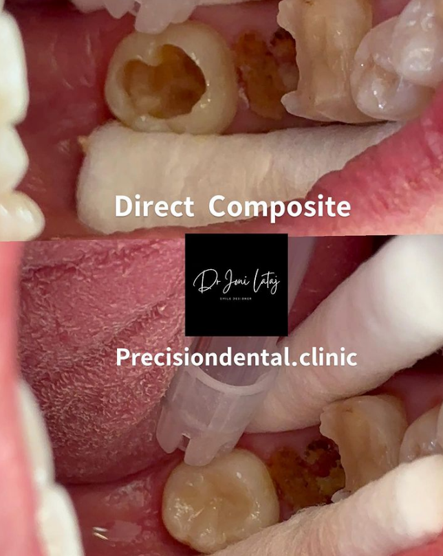 _________dentist-tirane-13