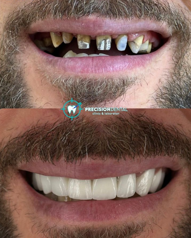 _________dentist-tirane-14