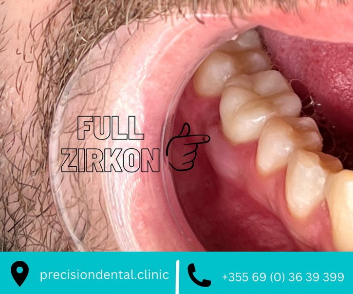 _________dentist-tirane-15