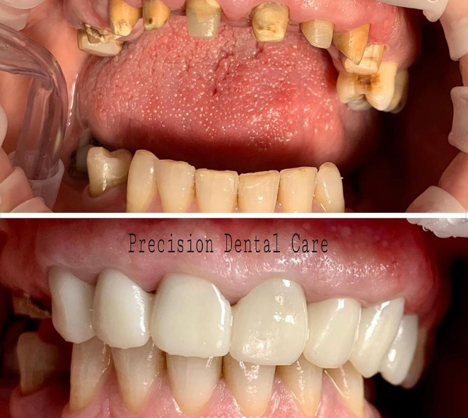 _________dentist-tirane-17