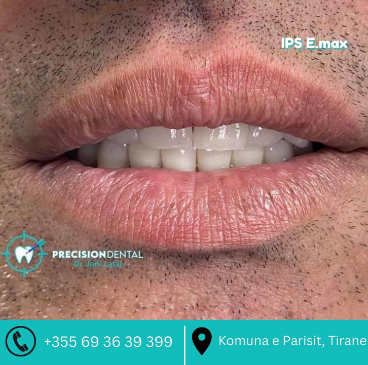 _________dentist-tirane-18