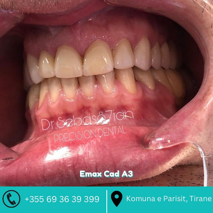 _________dentist-tirane-19