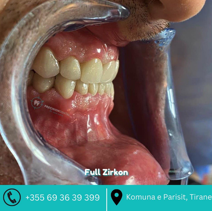 _________dentist-tirane-191