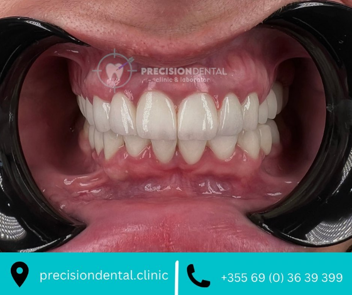 _________dentist-tirane-194