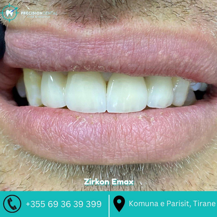 _________dentist-tirane-196