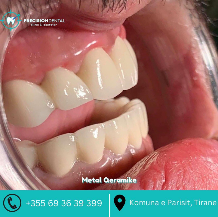 _________dentist-tirane-197