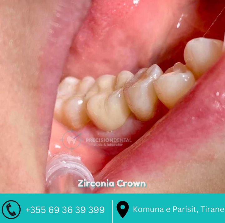 _________dentist-tirane-198
