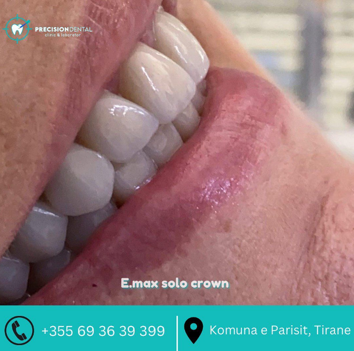 _________dentist-tirane-199