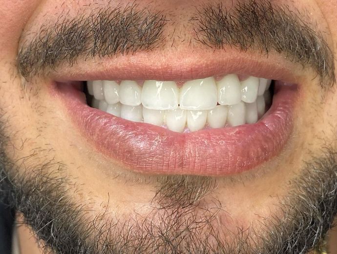 aiden-dental-dentist-tirane-15