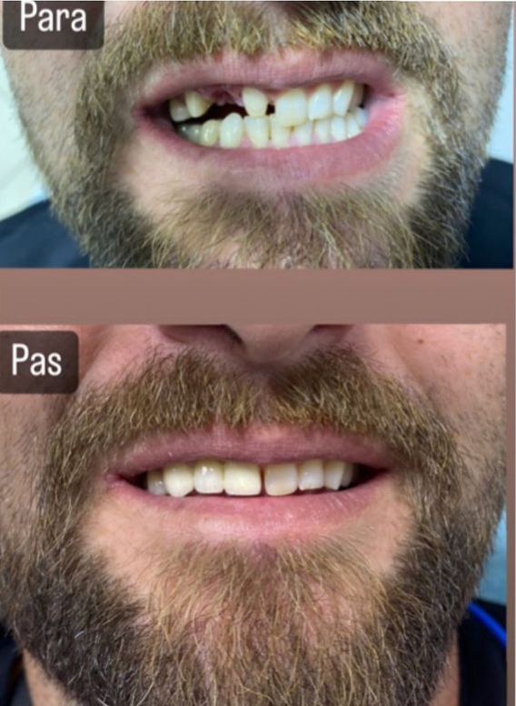 aiden-dental-dentist-tirane-19