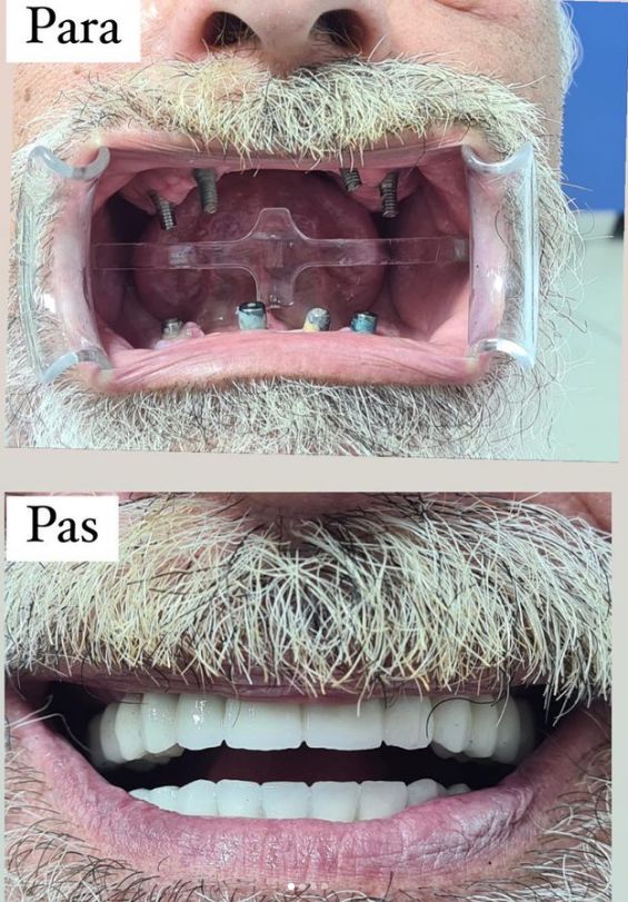 aiden-dental-dentist-tirane-190