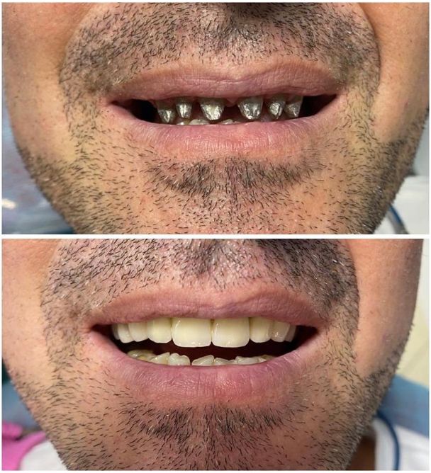 aiden-dental-dentist-tirane-1900