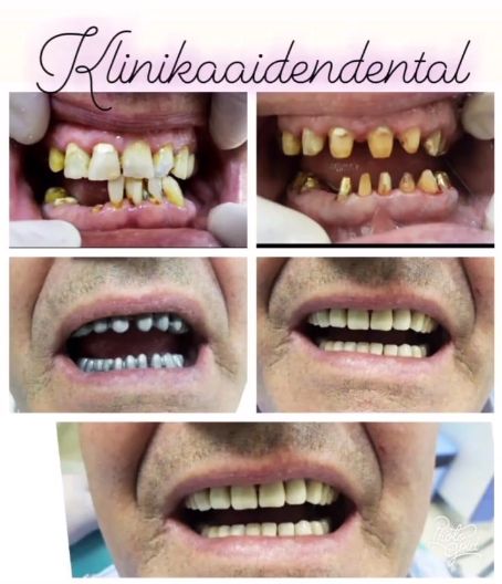 aiden-dental-dentist-tirane-191