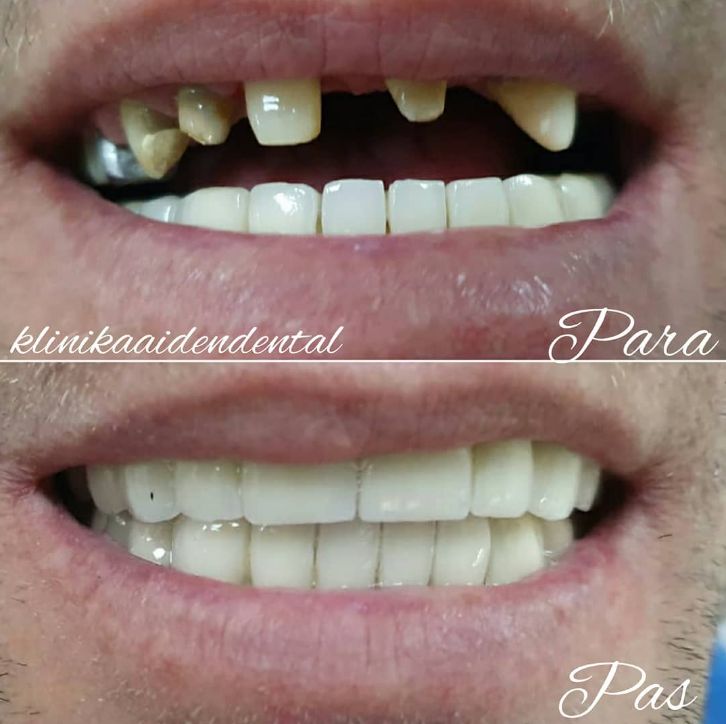 aiden-dental-dentist-tirane-193