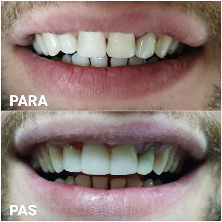 aiden-dental-dentist-tirane-194