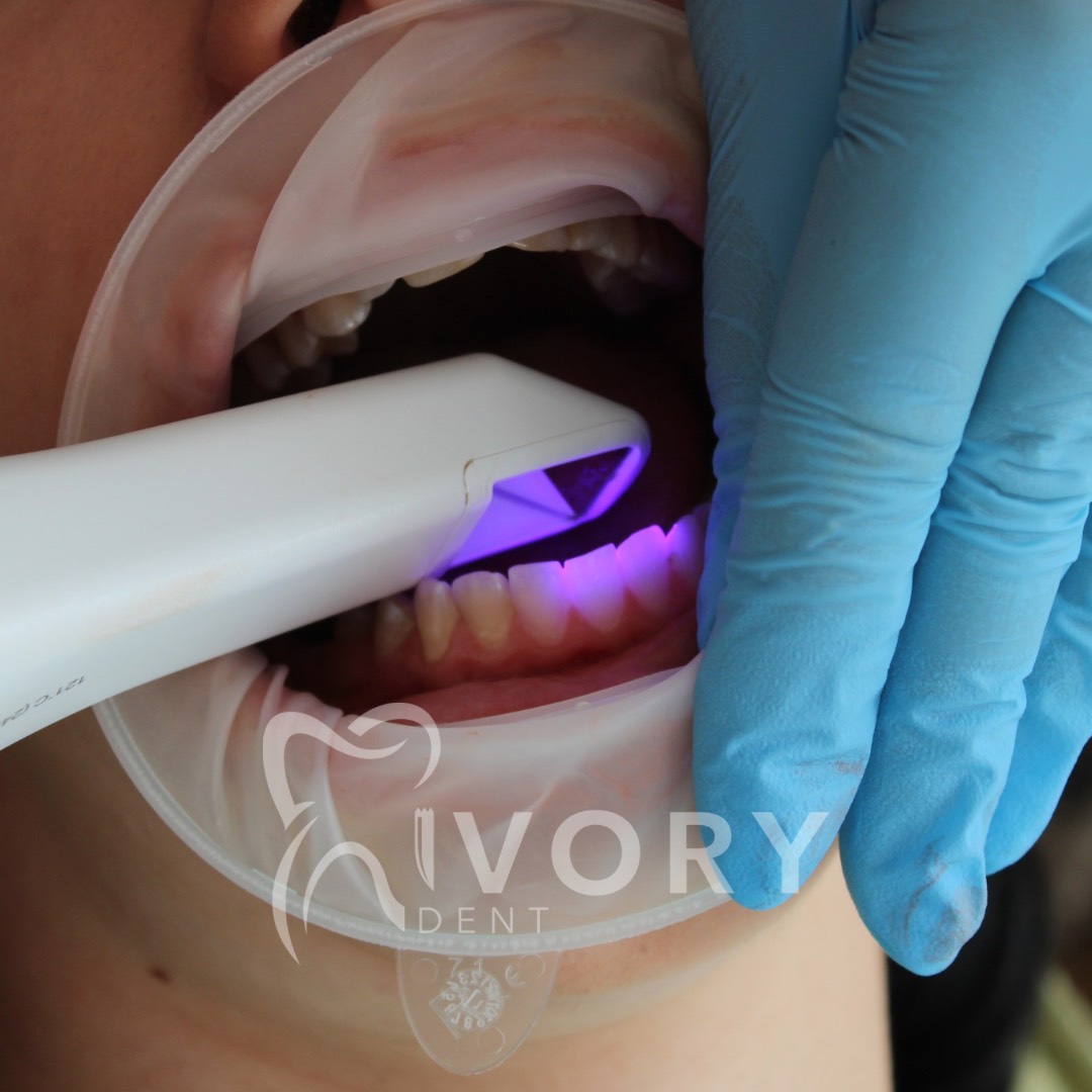 implante-dentist-dentare-kodra-diellit-19 implante-dentist-dentare-kodra-diellit-19