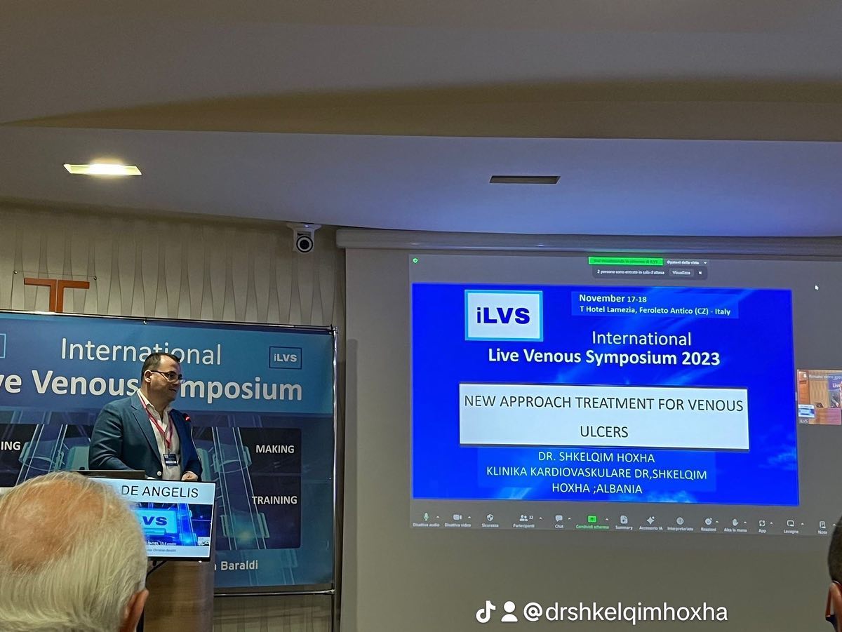 sherimi-variceve-trompozes-1