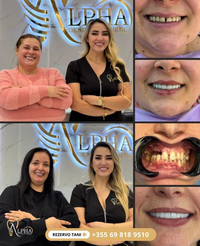 ALPHA-DENTAL-AESTHETIC11