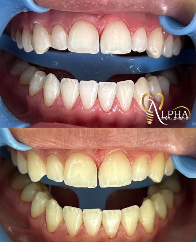 ALPHA-DENTAL-AESTHETIC12