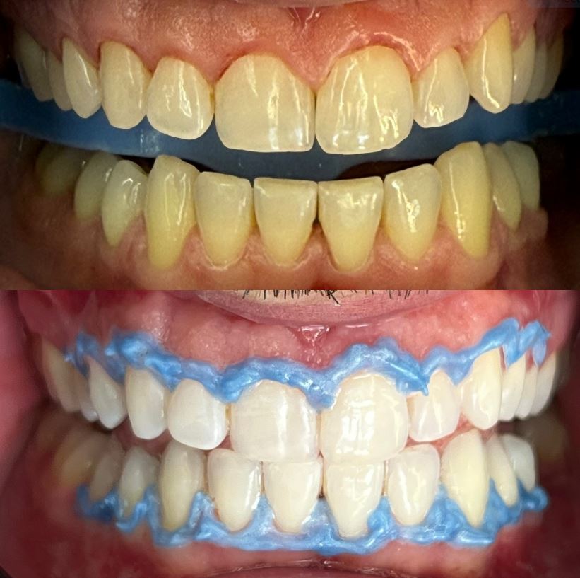 ALPHA-DENTAL-AESTHETIC15