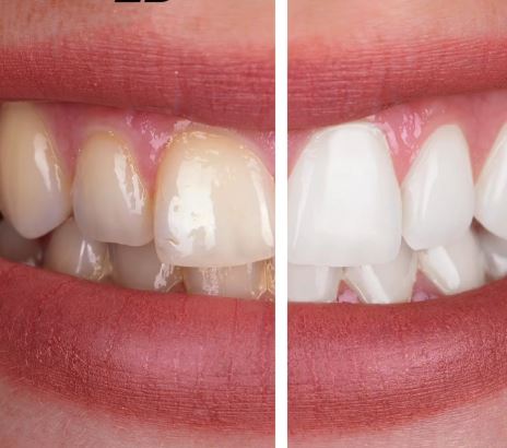 ALPHA-DENTAL-AESTHETIC17