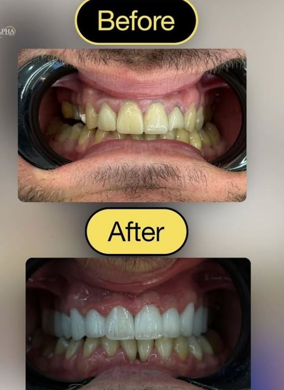 ALPHA-DENTAL-AESTHETIC9