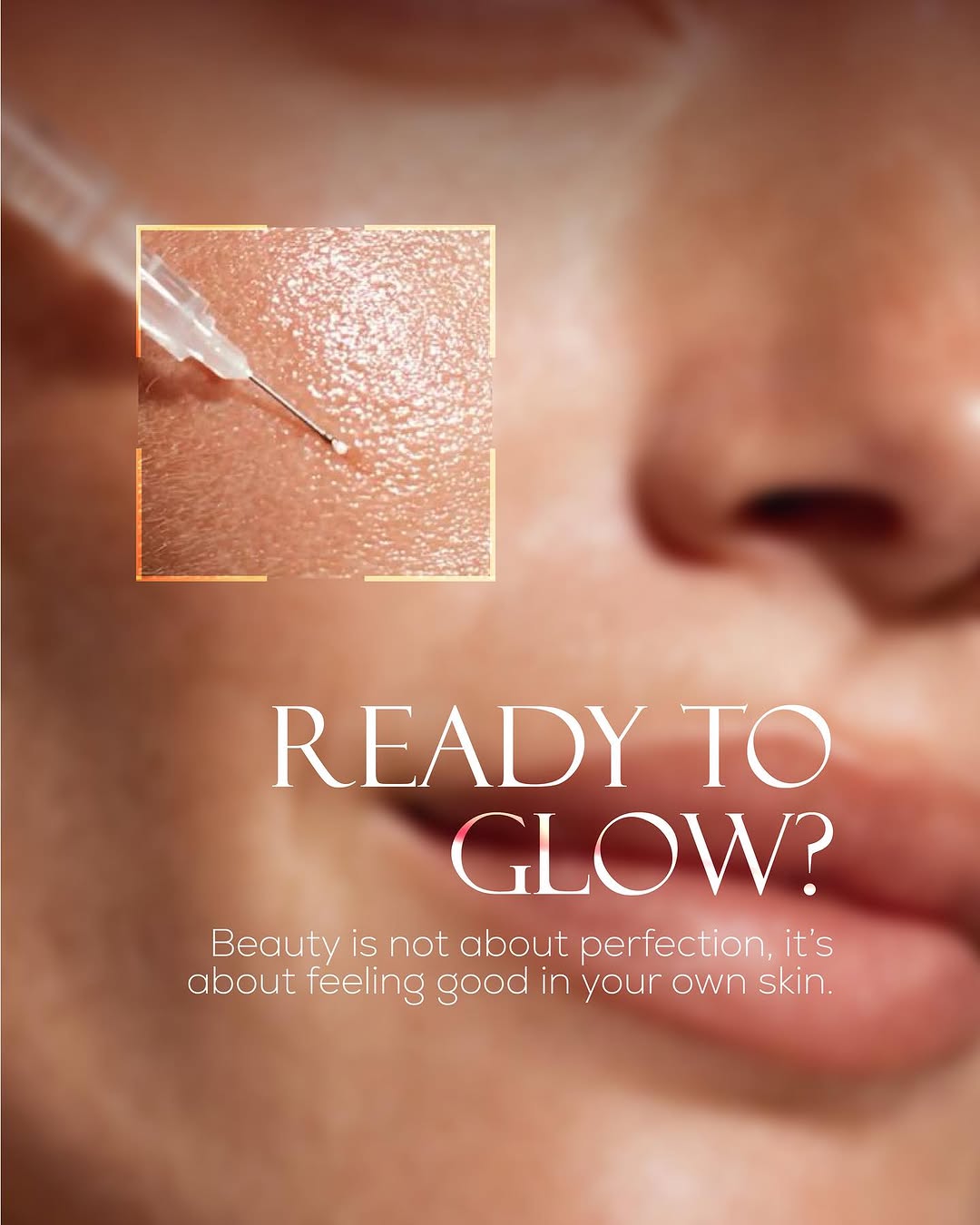 _________________myslym-shyri-estetike-qender-16