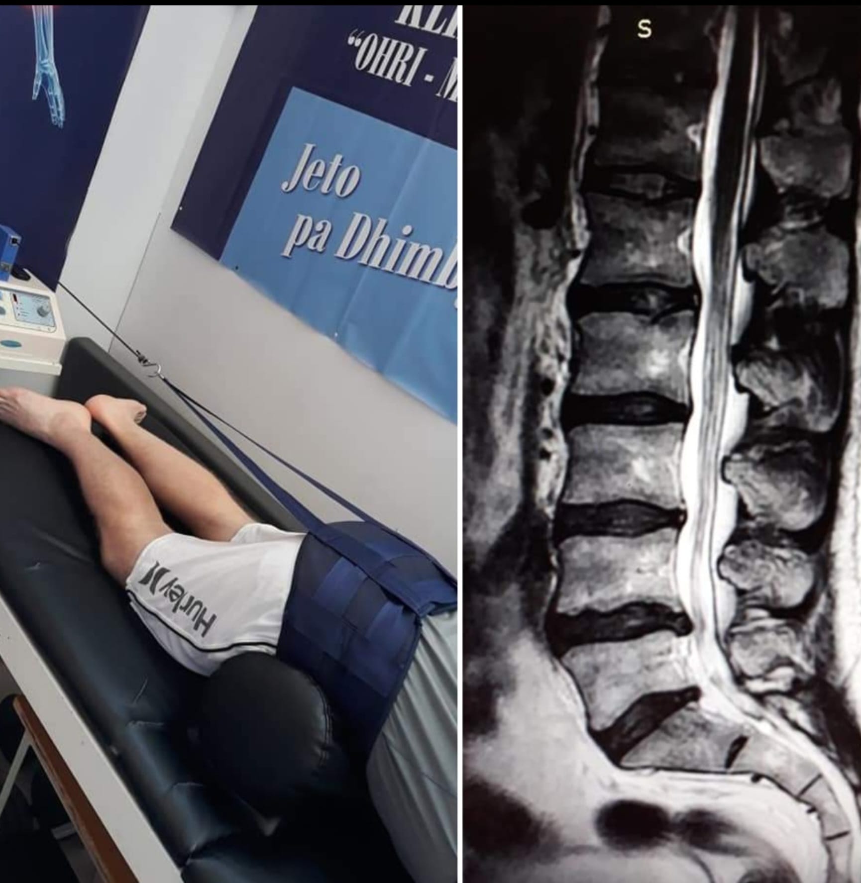 ____________fizioterapi-klinike-fizioterapist-tirane-194