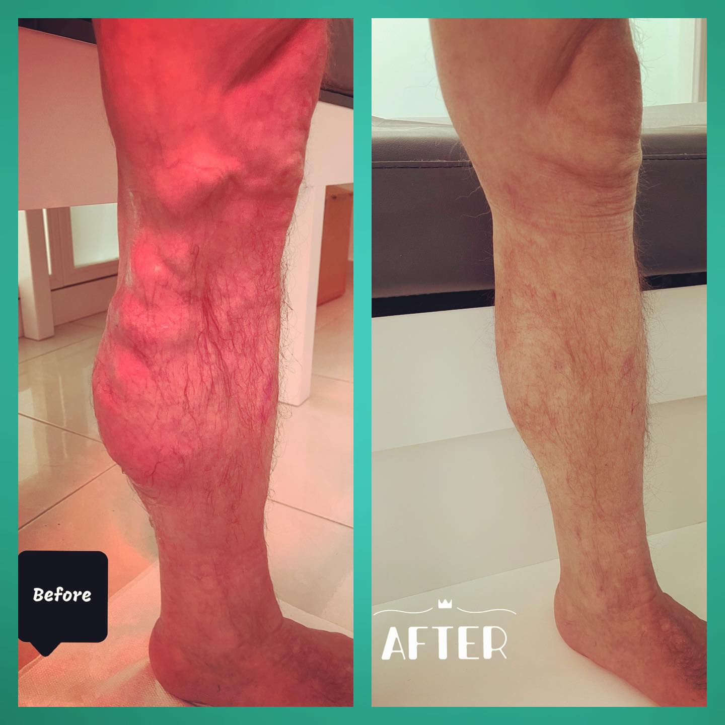 varicet-doktor-per-klinike-12