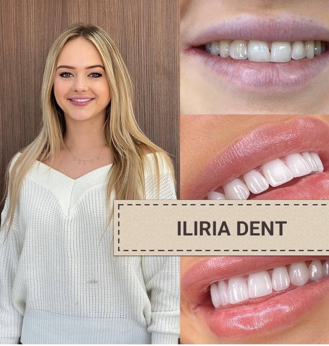 ____DENTISTE-NE-TIRANE-KLINIKE-1012